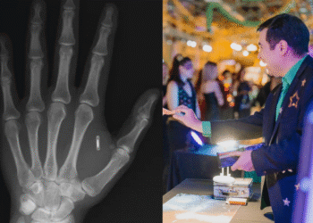 “Забыл пароль от собственной руки”: фокусник имплантировал RFID-чип, а потом потерял к нему доступ