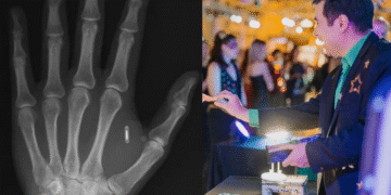 “Забыл пароль от собственной руки”: фокусник имплантировал RFID-чип, а потом потерял к нему доступ